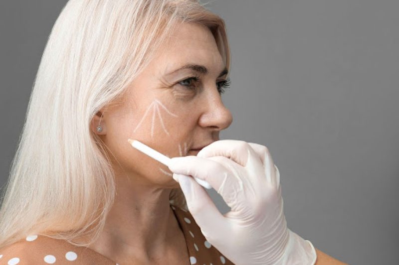 How much does a facelift cost